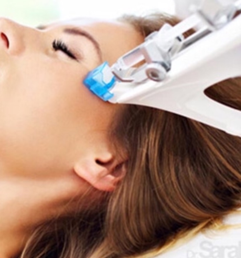 mesotherapy at Beauty Medical Clinic