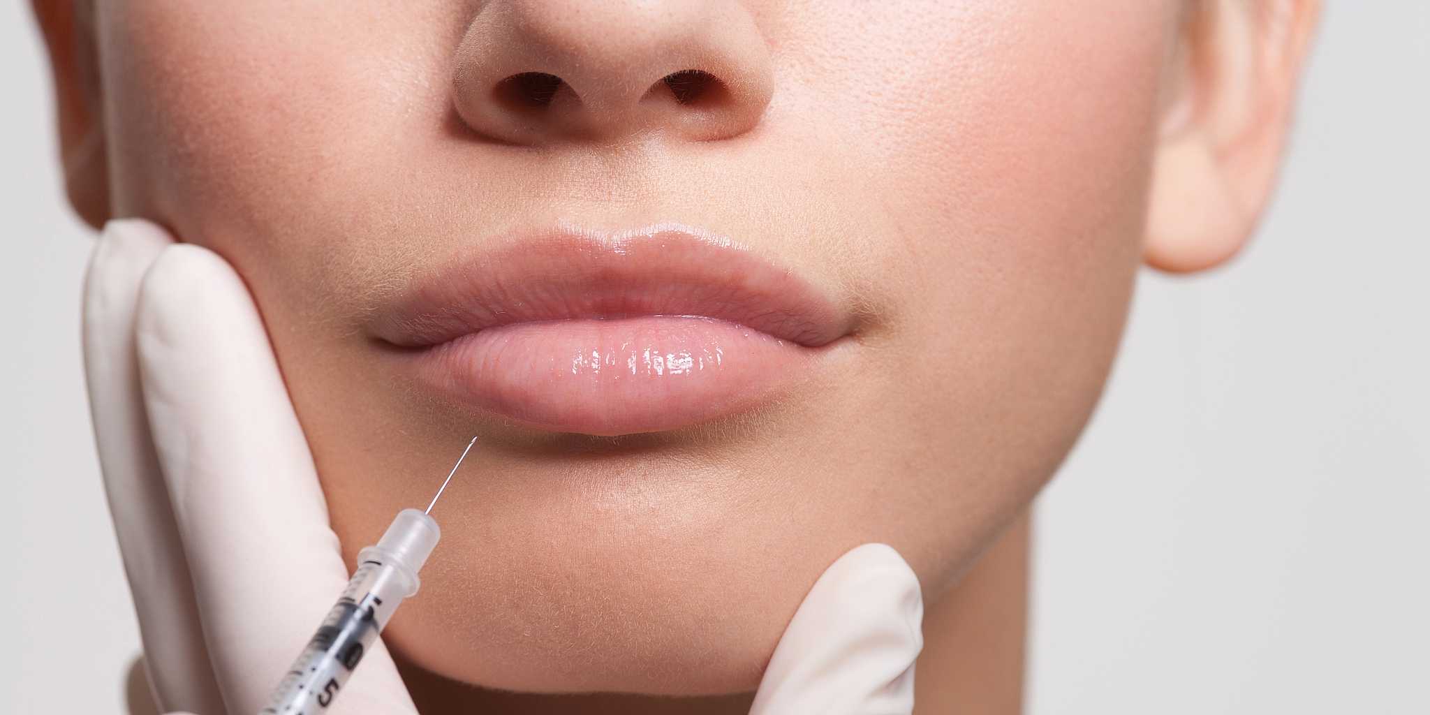 your perfect lips