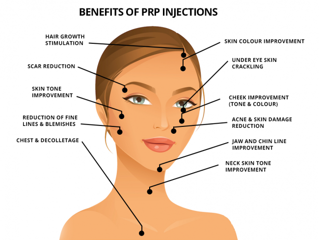 PRP Rejuvenation – Beauty Medical Clinic