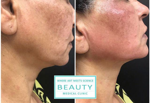 forma before and after