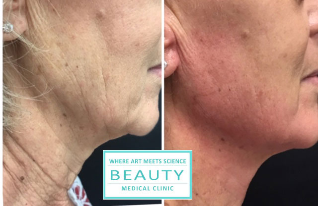 My client. forma before and after