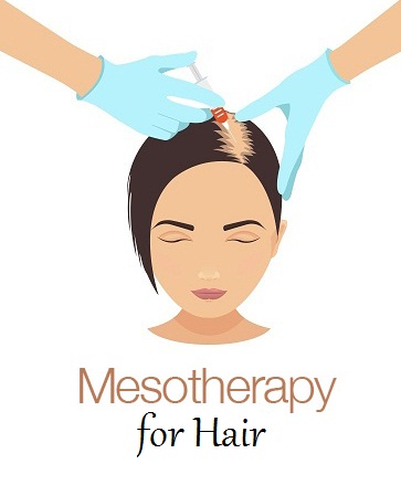 Mesotherapy-An-Innovative-Treatment-for-Hair-Loss